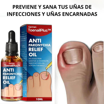 🔥 ¡VERGÜENZA NUNCA MÁS! ELIMINA LOS HONGOS DE TUS UÑAS CON UN TRATAMIENTO 100% NATURAL, SEGURO Y EFICAZ 💚✨