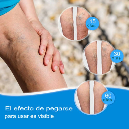 ✨😍 ¡¡ADIÓS A LAS VARICES! EL TRATAMIENTO- SECRETO Y NATURAL PARA UNAS PIERNAS SALUDABLES Y LIGERAS 💚✨